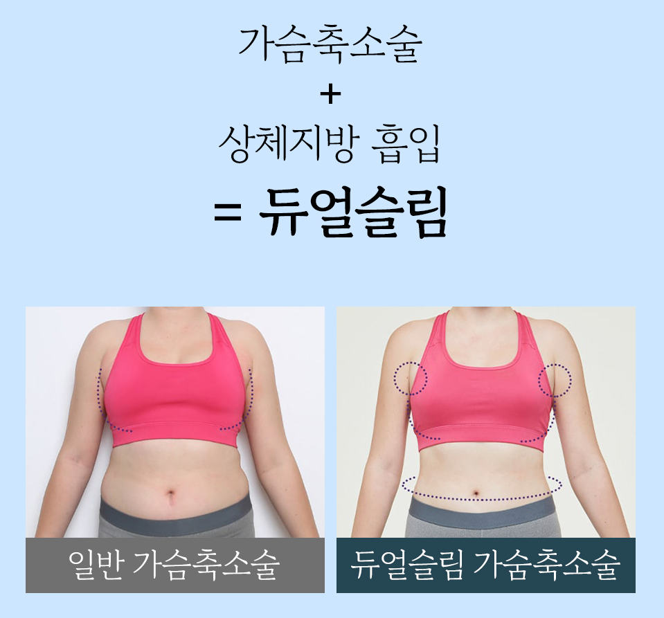 가슴 축소술의 다양한 수술법과 수술 후 관리법 관련 이미지 7