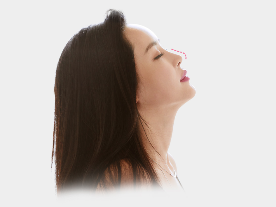 코성형보형물 코재수술 부작용이 있다면? 설명드립니다. 관련 이미지 10