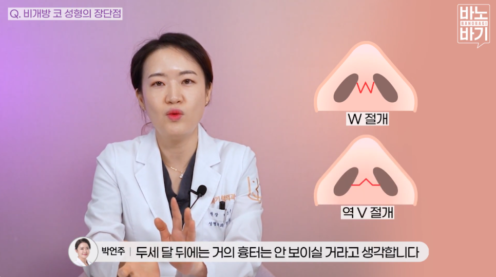 개방/비개방 코성형의 장/단점 알아보기! 관련 이미지 7