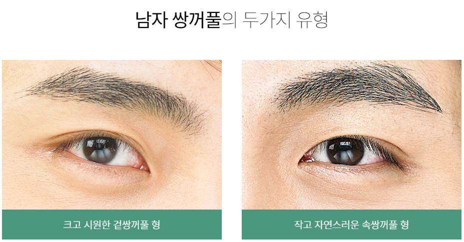 자연스러운 남자 눈매, 바노바기 남자 쌍꺼풀! 관련 이미지 2