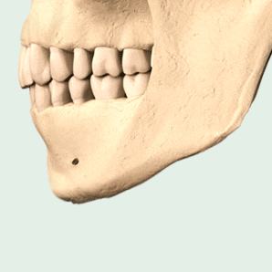 앞턱 수술, 얼굴형과 조화를 이루는 턱 선이 작은 얼굴을 결정짓는다. 관련 이미지 5