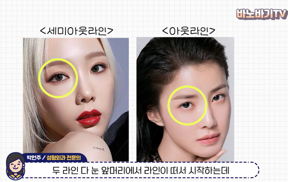 쌍꺼풀 라인의 종류와 나에게 어울리는 라인 찾기! 관련 이미지 12