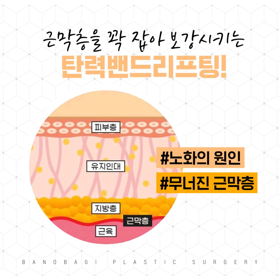 탄력밴드리프팅 얼굴리프팅은 동안성형 전문가에게 맡기세요! 관련 이미지 3