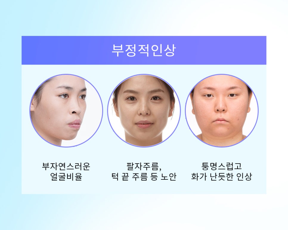 유형에 따라 달라지는 돌출입 수술 방법 관련 이미지 2