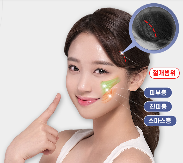 뼈 수술 없이 숨은 브이라인 찾기! 관련 이미지 3