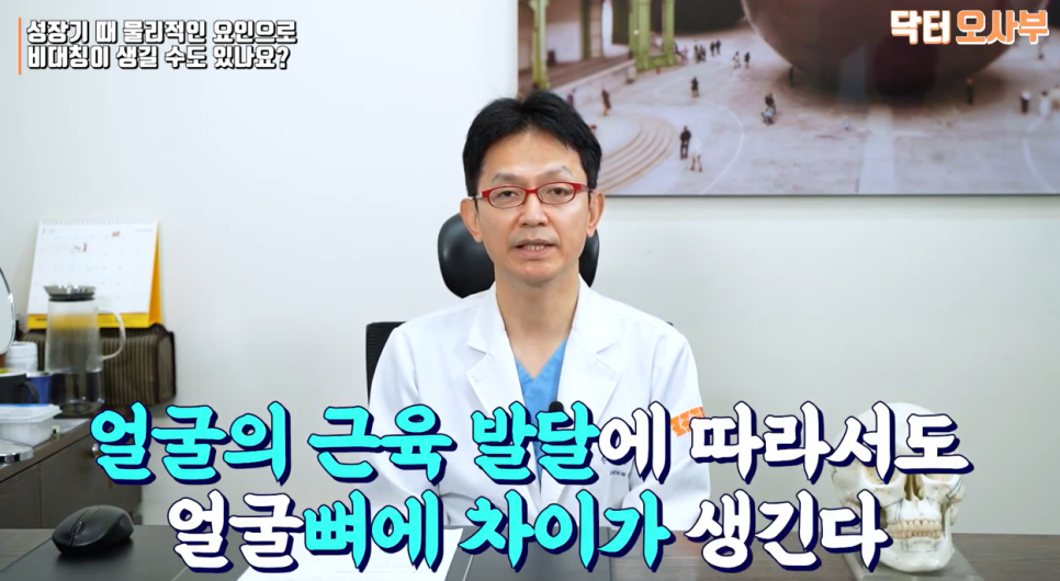 안면비대칭 수술 후 다시 비대칭으로 돌아갈까요? 관련 이미지 3