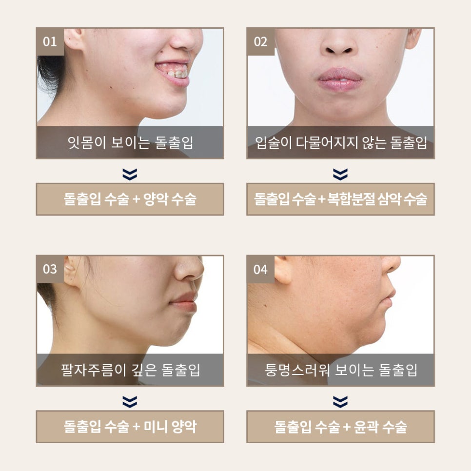 돌출입 정확한 진단으로 확실하게 개선하는 것이 중요! 관련 이미지 3