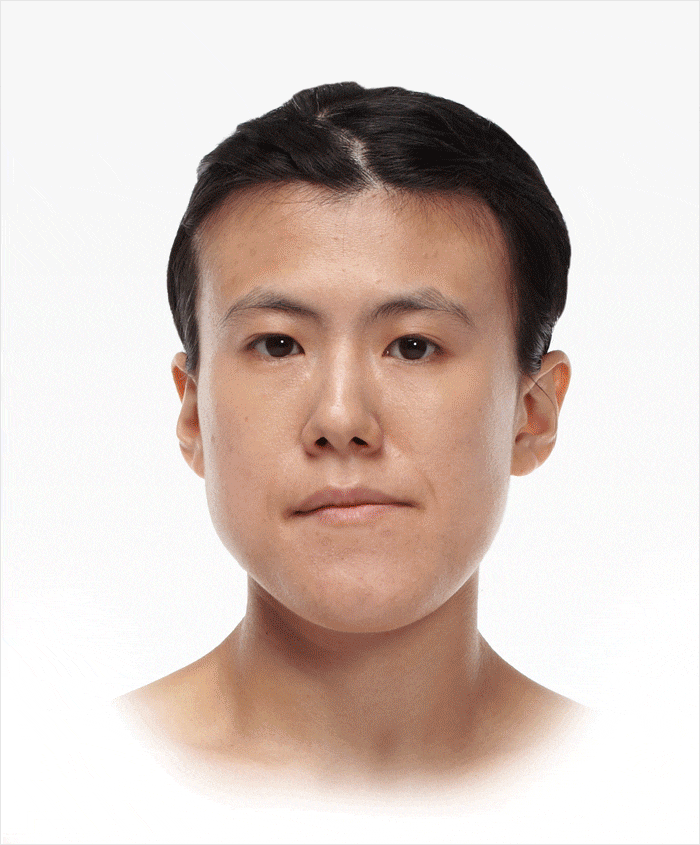 양악수술잘하는곳 경험을 따져야 하는 이유! 관련 이미지 5