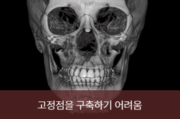 윤곽 재수술 경험과 기술을 갖춘 전문의에게 받아야 합니다. 관련 이미지 4