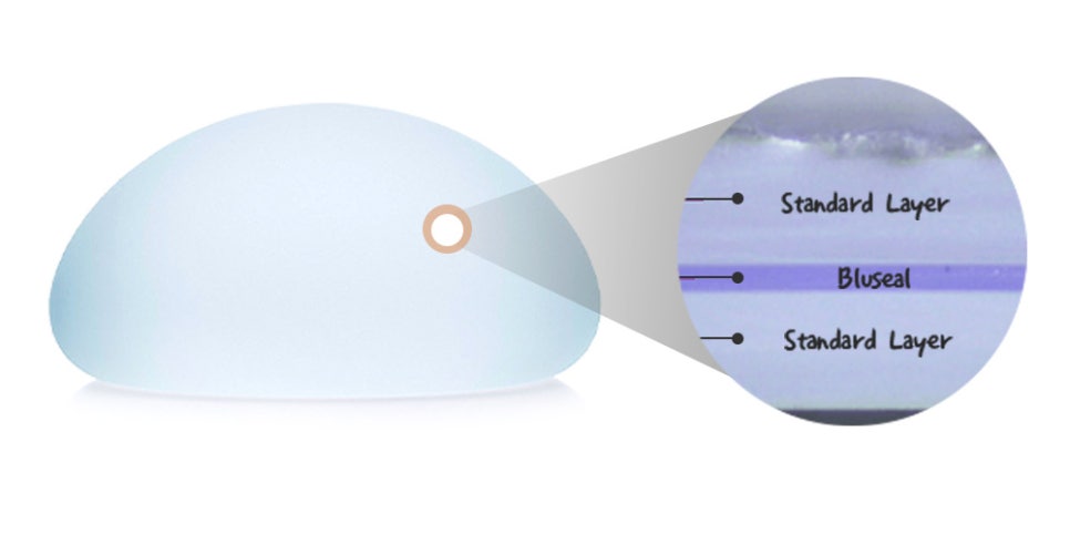 바노바기 가슴 성형, 모티바 더 퍼플이란? 관련 이미지 5