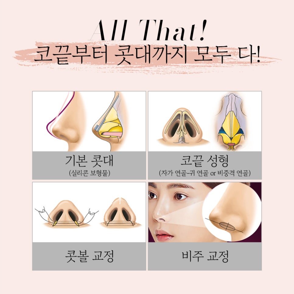 콧대부터 코끝까지 한 번에 끝내는 바노바기 코 성형 관련 이미지 3