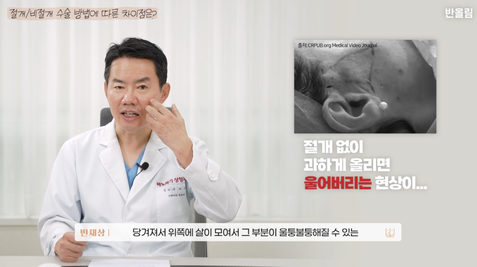 엘라스티꿈 실리프팅의 5배 유지기간??? 관련 이미지 5