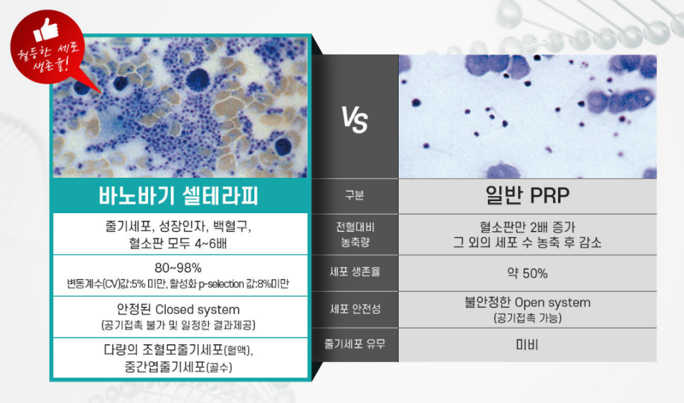 줄기세포 정맥주사로 통증 완화, 면역 증진, 피부 재생까지 한 번에! 관련 이미지 4