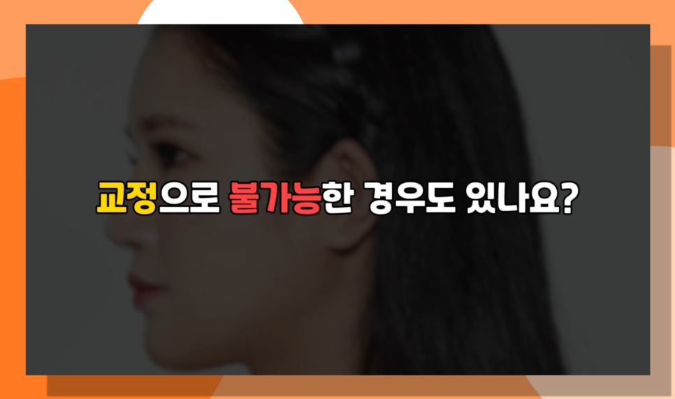 돌출입수술 잇몸돌출교정이란 무엇일까요? 오사부가 제대로 알려준다! 관련 이미지 7