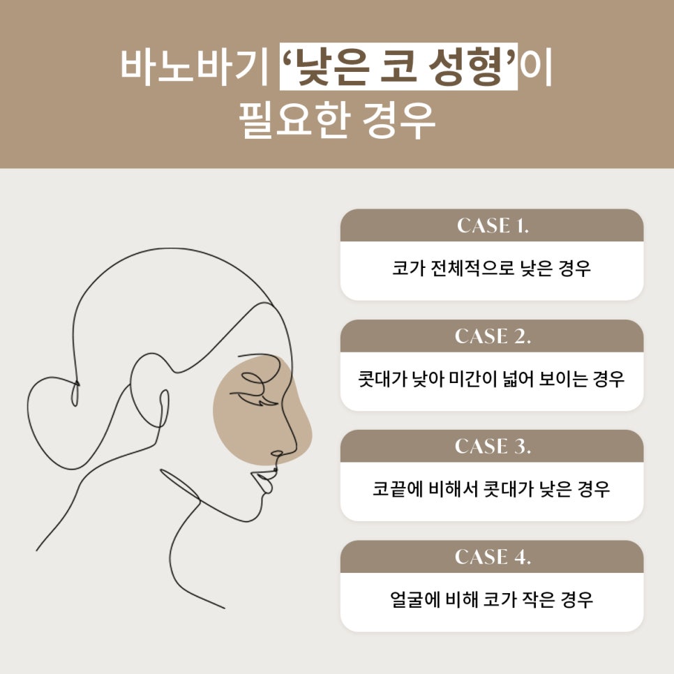 낮은 코 성형으로 입체감 있는 얼굴을! 관련 이미지 2