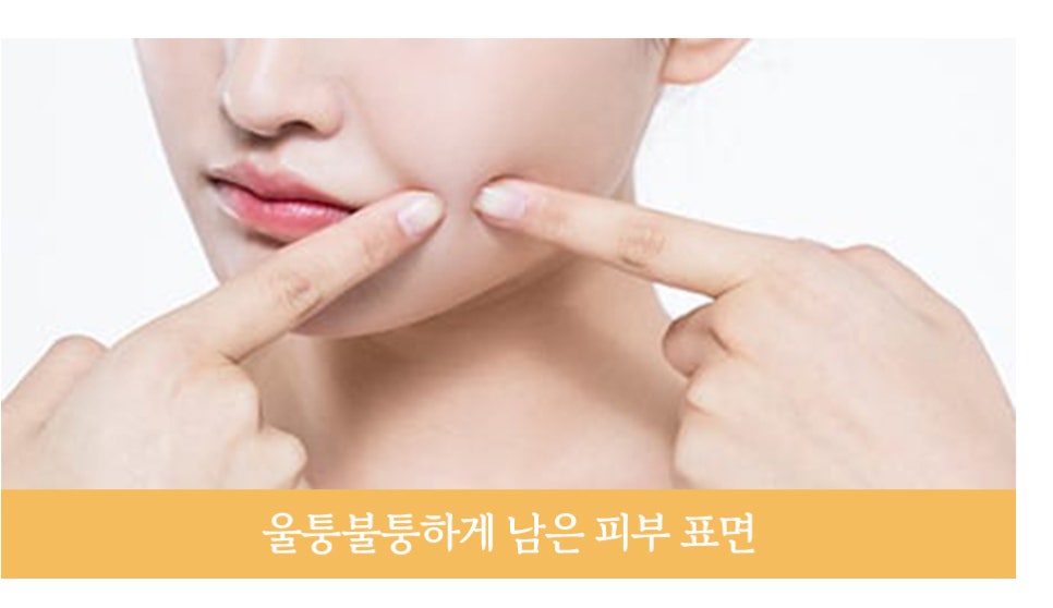 동안 재수술의 다양한 원인과 재수술 시기 관련 이미지 4