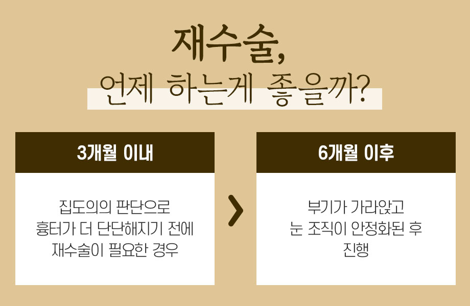 눈 재수술의 원인과 재수술 시기 관련 이미지 3