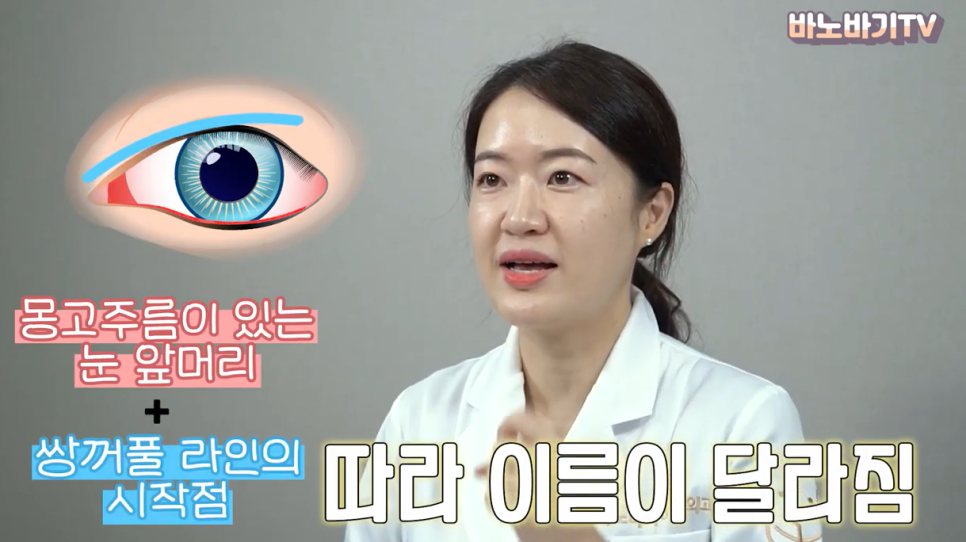 쌍꺼풀 라인의 종류와 나에게 어울리는 라인 찾기! 관련 이미지 3