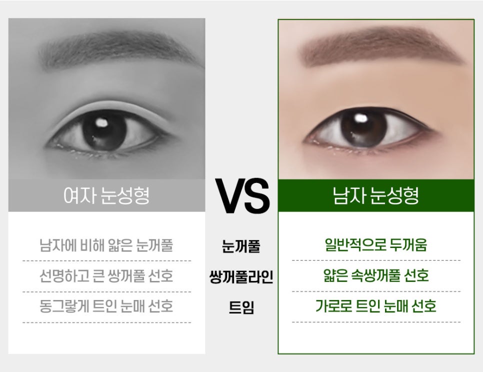 남자 눈 성형, 자연스럽고 또렷한 인상으로! 관련 이미지 2