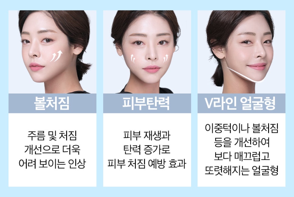 피부 탄력 증가, 얼굴형 개선까지 가능한 바노바기 탄력리프팅! 관련 이미지 2