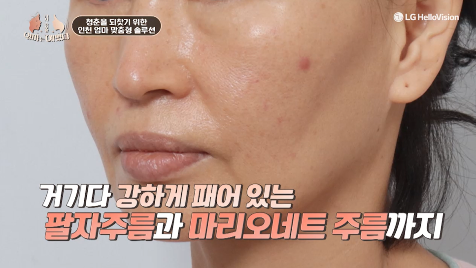 엄마는 예뻤다 12화 - 인천 엄마의 뷰티 솔루션 관련 이미지 11