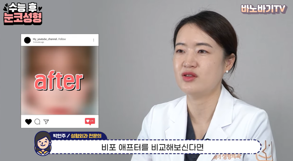 수능 후 눈, 코 성형같이 하는 게 좋을까요? 따로 하는 게 좋을까요? 관련 이미지 15