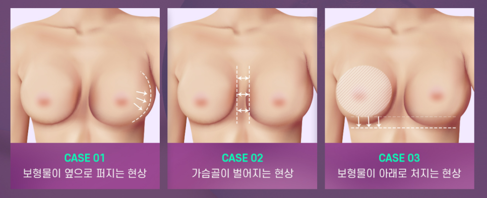 바노바기 모티바 더 퍼플로 결정해야 하는 이유! 관련 이미지 4