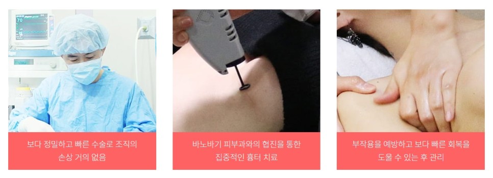 가슴성형재수술 가슴성형외과는 집도의의 경험을 따져야합니다. 관련 이미지 6