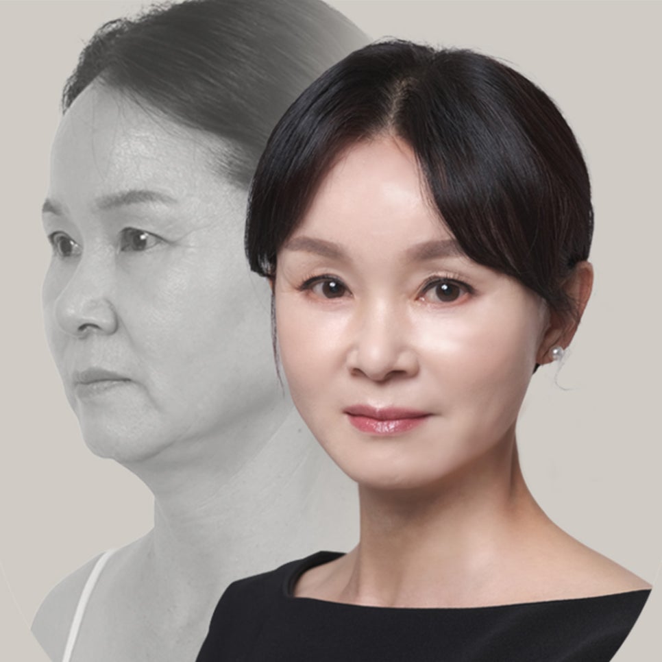 바노바기 탄력밴드 리프팅의 특징과 장점 관련 이미지 6