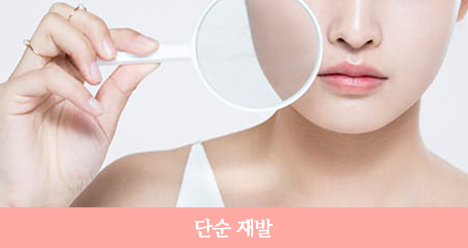 안면거상 재수술, 정확한 원인 분석으로 확실한 개선! 관련 이미지 6