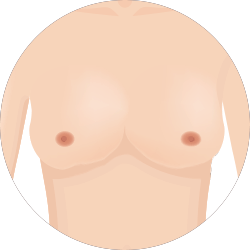 가슴성형재수술 가슴성형외과는 집도의의 경험을 따져야합니다. 관련 이미지 3