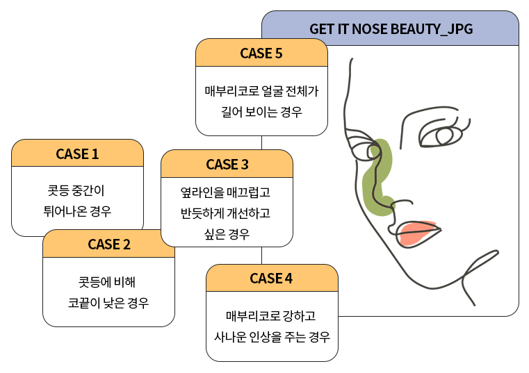 굴곡 없이 매끄럽게! 매부리코성형 관련 이미지 2