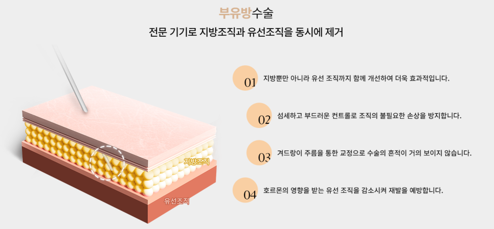 부유방 수술로 매끄러운 겨드랑이 라인을 만들자! 관련 이미지 3