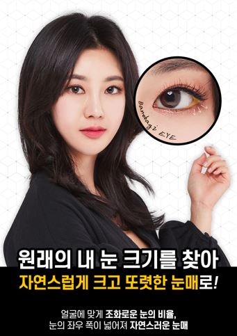 트임성형은 내 얼굴에 맞게 조화로운 비율로! 관련 이미지 6