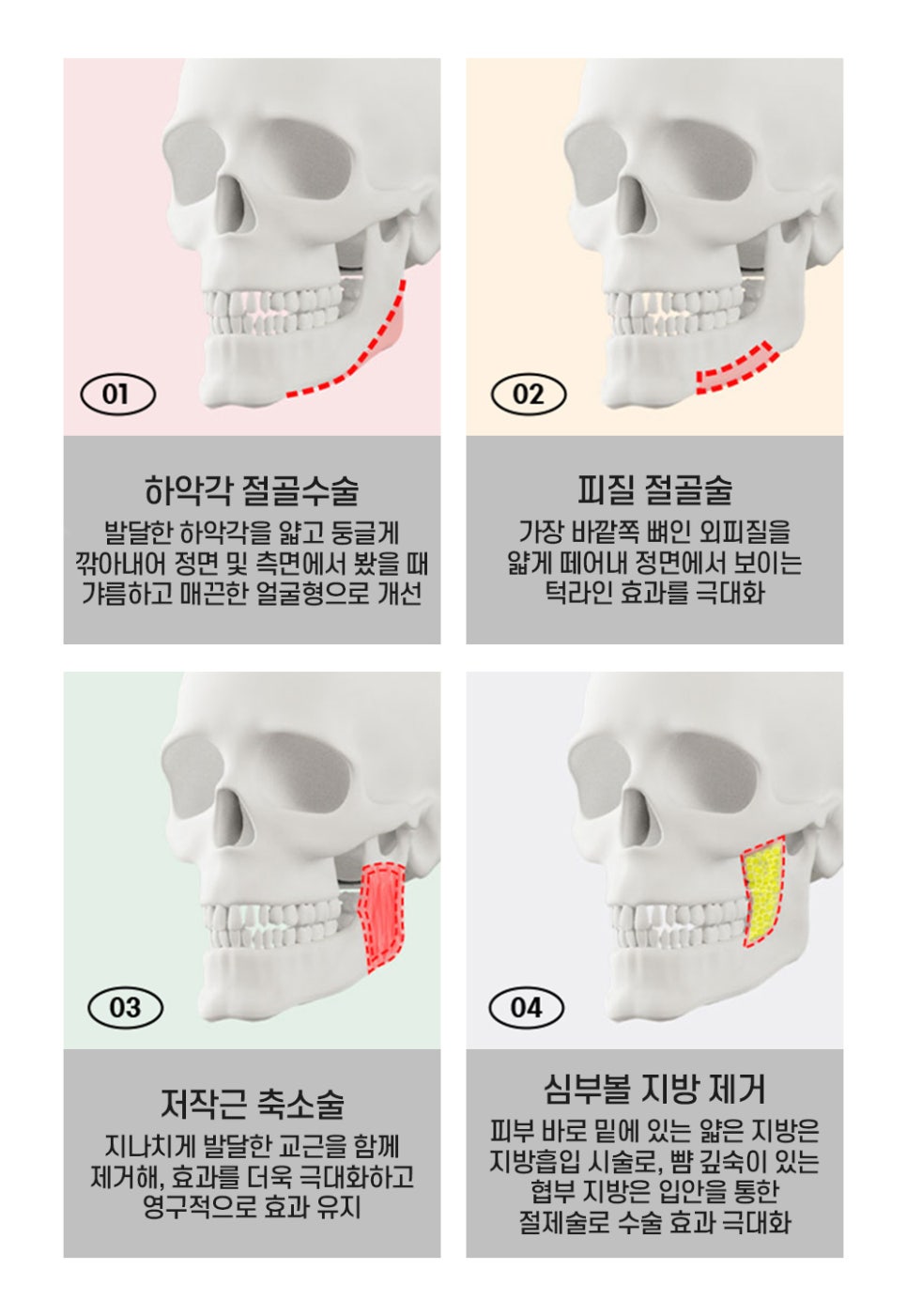 차별화된 방법으로 접근하는 남자 안면윤곽 관련 이미지 4