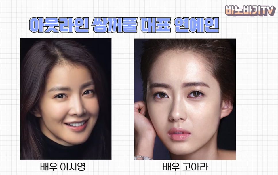 쌍꺼풀 라인의 종류와 나에게 어울리는 라인 찾기! 관련 이미지 11