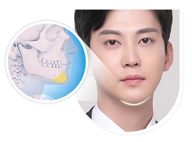 차별화된 방법으로 접근하는 남자 안면윤곽 관련 이미지 5