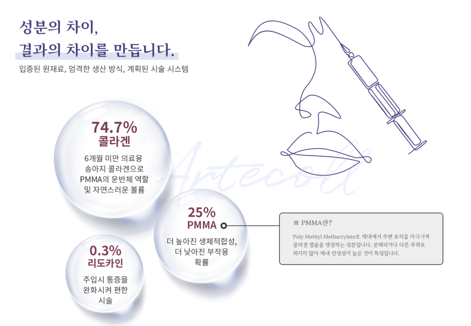 오래가는 아름다움, 반영구 필러 아테콜 관련 이미지 2