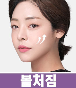 볼 처짐, 이중턱, 턱 라인 비절개 실리프팅으로 개선! 관련 이미지 2
