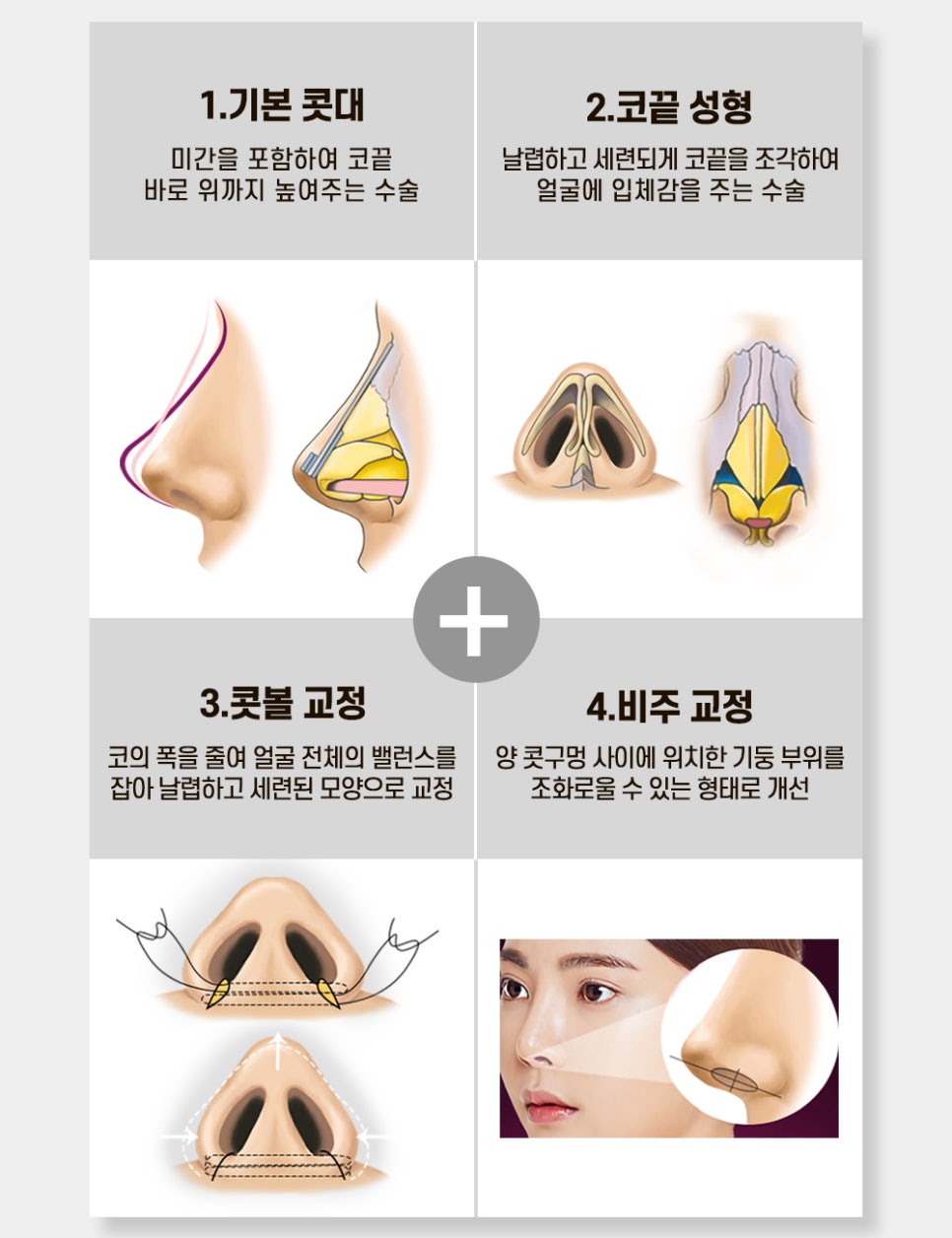코 성형, 바노바기 올댓코로 재수술 없이 한 번에 끝내자! 관련 이미지 2