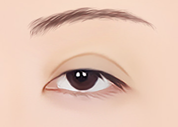 쌍꺼풀재수술잘하는병원 이 점을 따져보셔야합니다. 관련 이미지 3