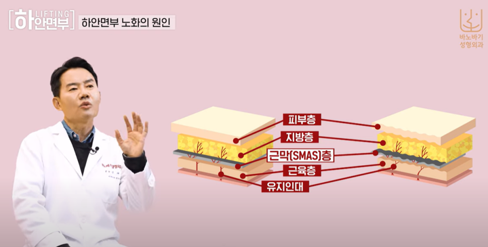 하안면부 리프팅의 장점과 노화의 원인 관련 이미지 2