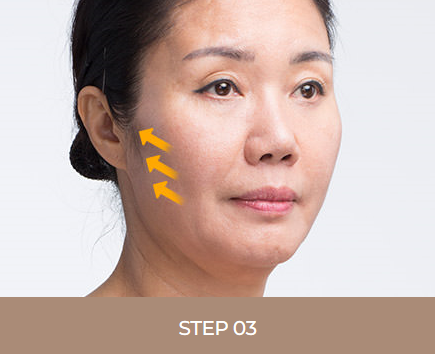 어떤 동안 성형보다 효과가 뛰어난 안면거상술 관련 이미지 5