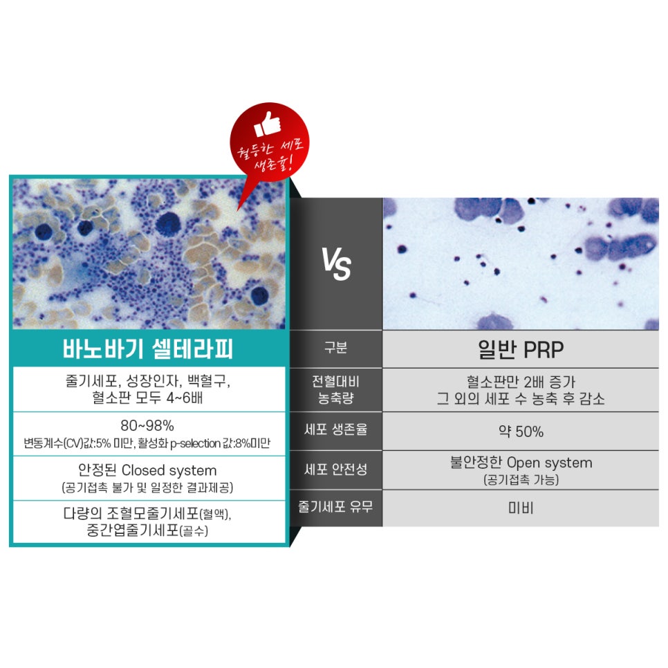 면역강화를 위한 프리미엄 웰에이징 프로그램! 줄기세포 인젝팅 샐테라피 관련 이미지 10