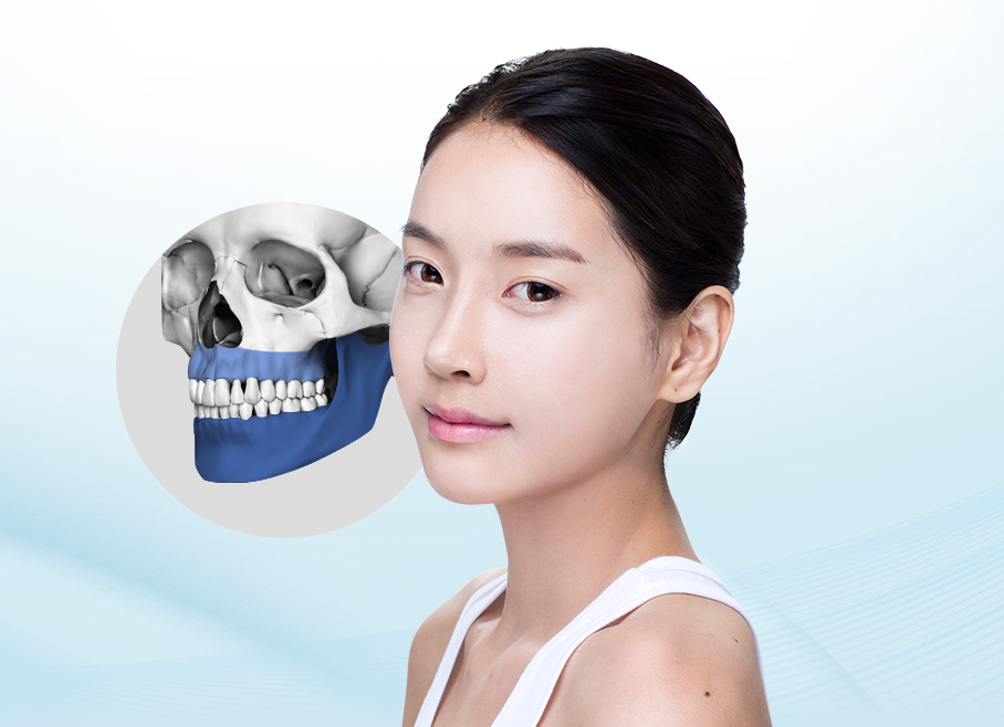 양악수술잘하는곳 경험을 따져야 하는 이유! 관련 이미지 1