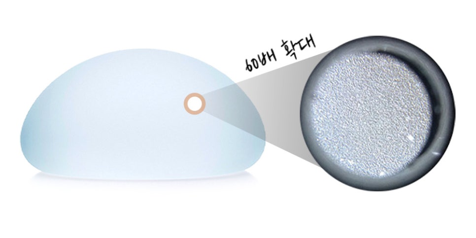 바노바기 가슴 성형, 모티바 더 퍼플이란? 관련 이미지 4