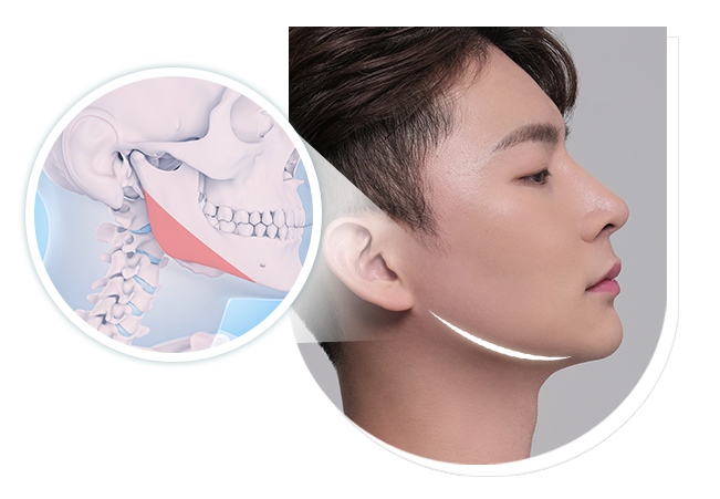 차별화된 방법으로 접근하는 남자 안면윤곽 관련 이미지 3