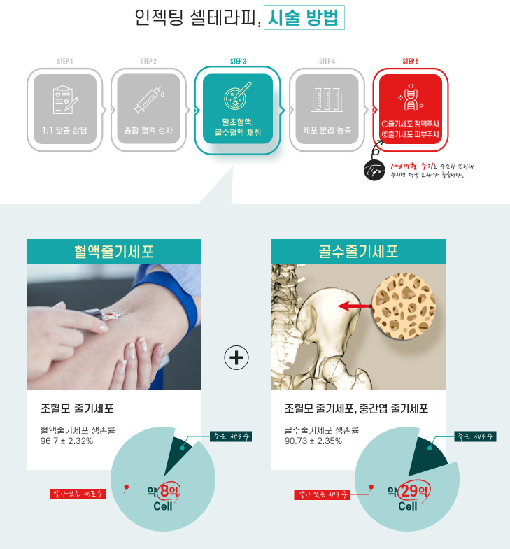 줄기세포 정맥주사로 통증 완화, 면역 증진, 피부 재생까지 한 번에! 관련 이미지 3