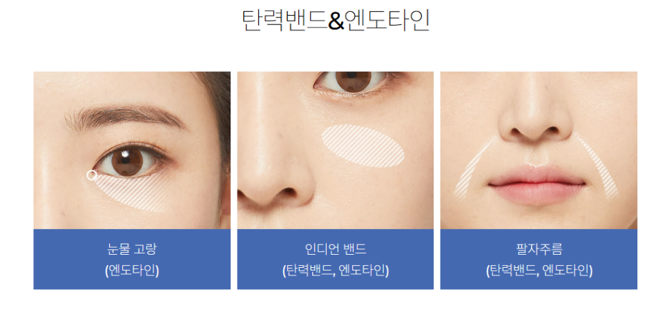 피부처짐까지 예방하는 바노바기 광대 성형! 관련 이미지 3