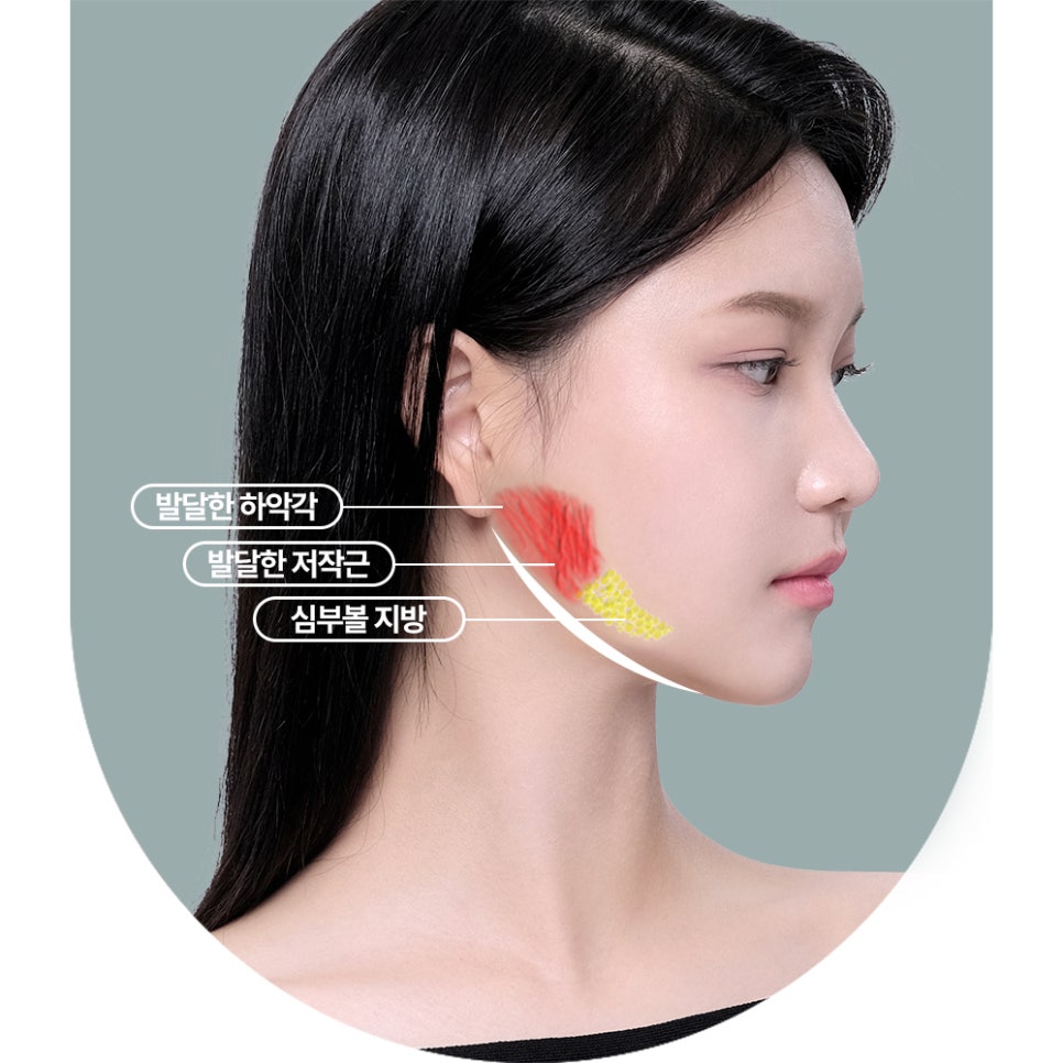 사각턱 수술, 나에게 맞는 라인으로 어느 각도에서도 매력적인 턱 라인 관련 이미지 2